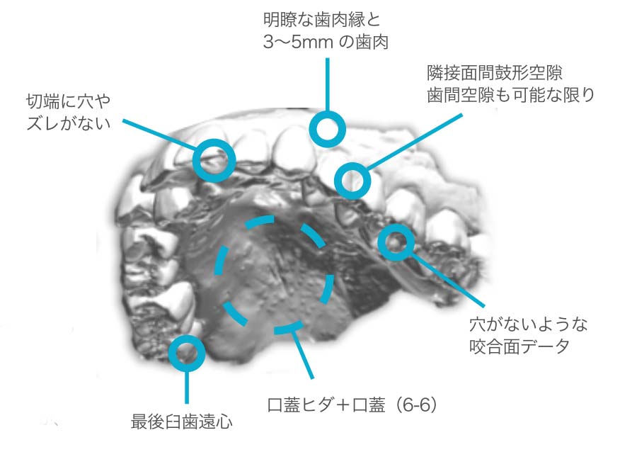 iosスキャン基準