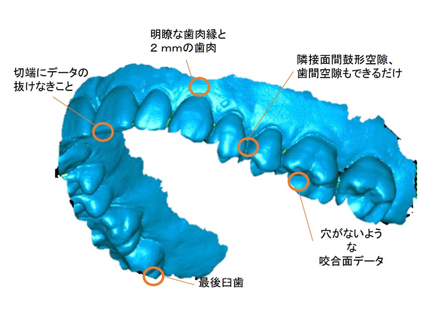 iosスキャン基準 iosスキャン基準