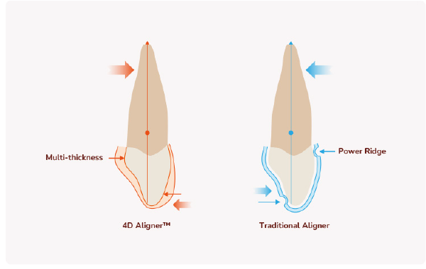 Multi-Thickness Control