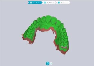 治療初期にはパッシブに スキャン精度の検出
