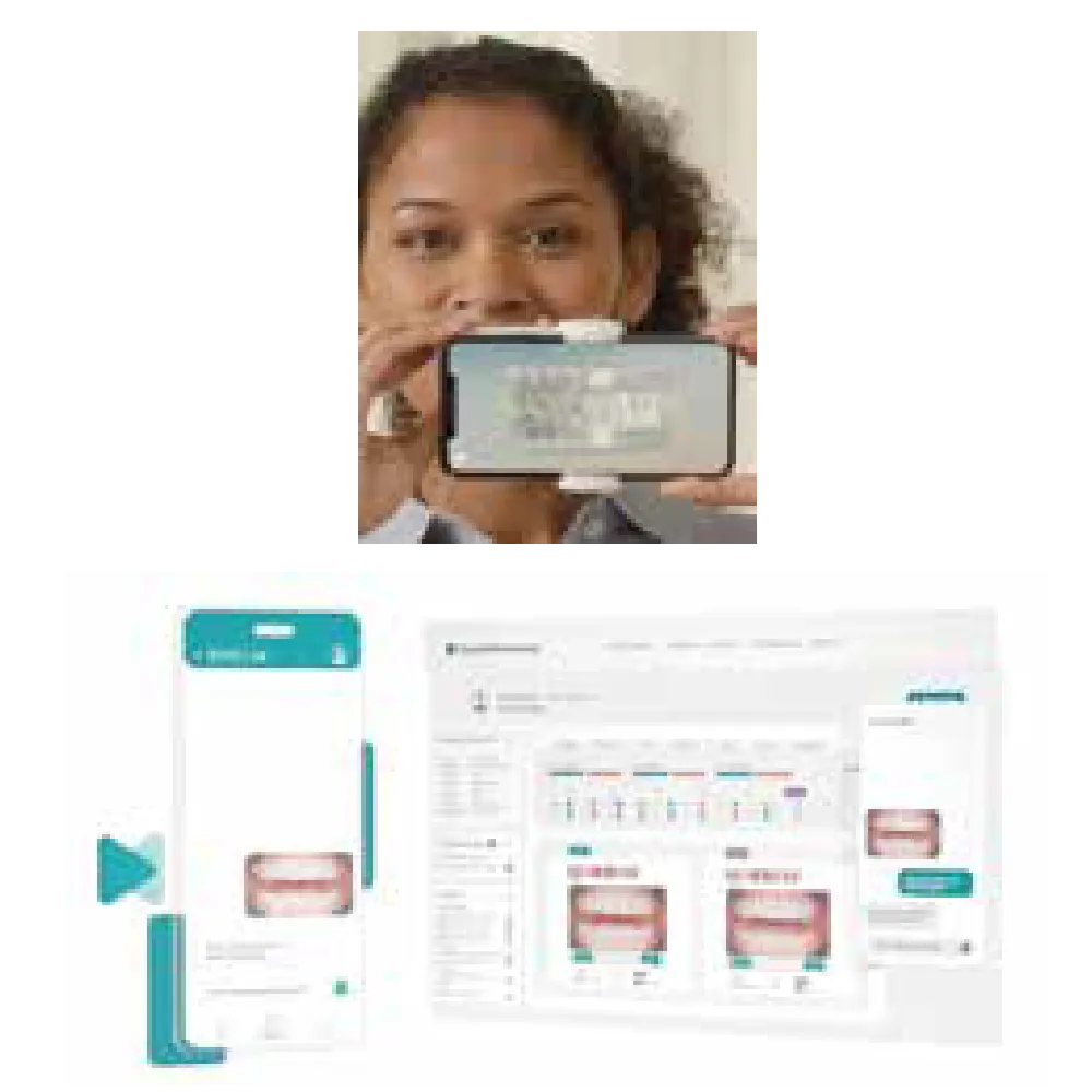 アライナー矯正治療＋αで診療の新時代！頼れる味方がもたらす変化