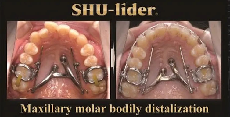 SHU-lider
