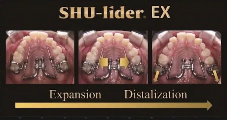 SHU-lider