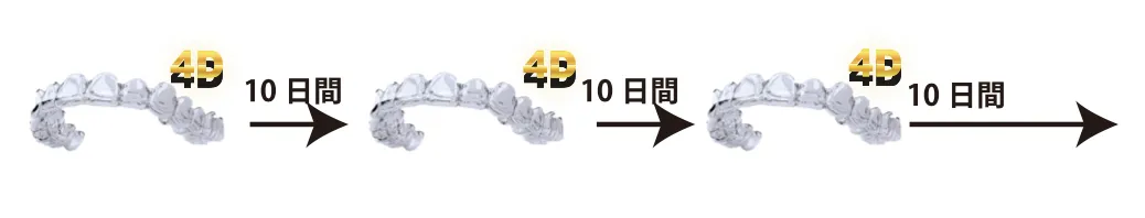 マウスピース交換タイミング図
