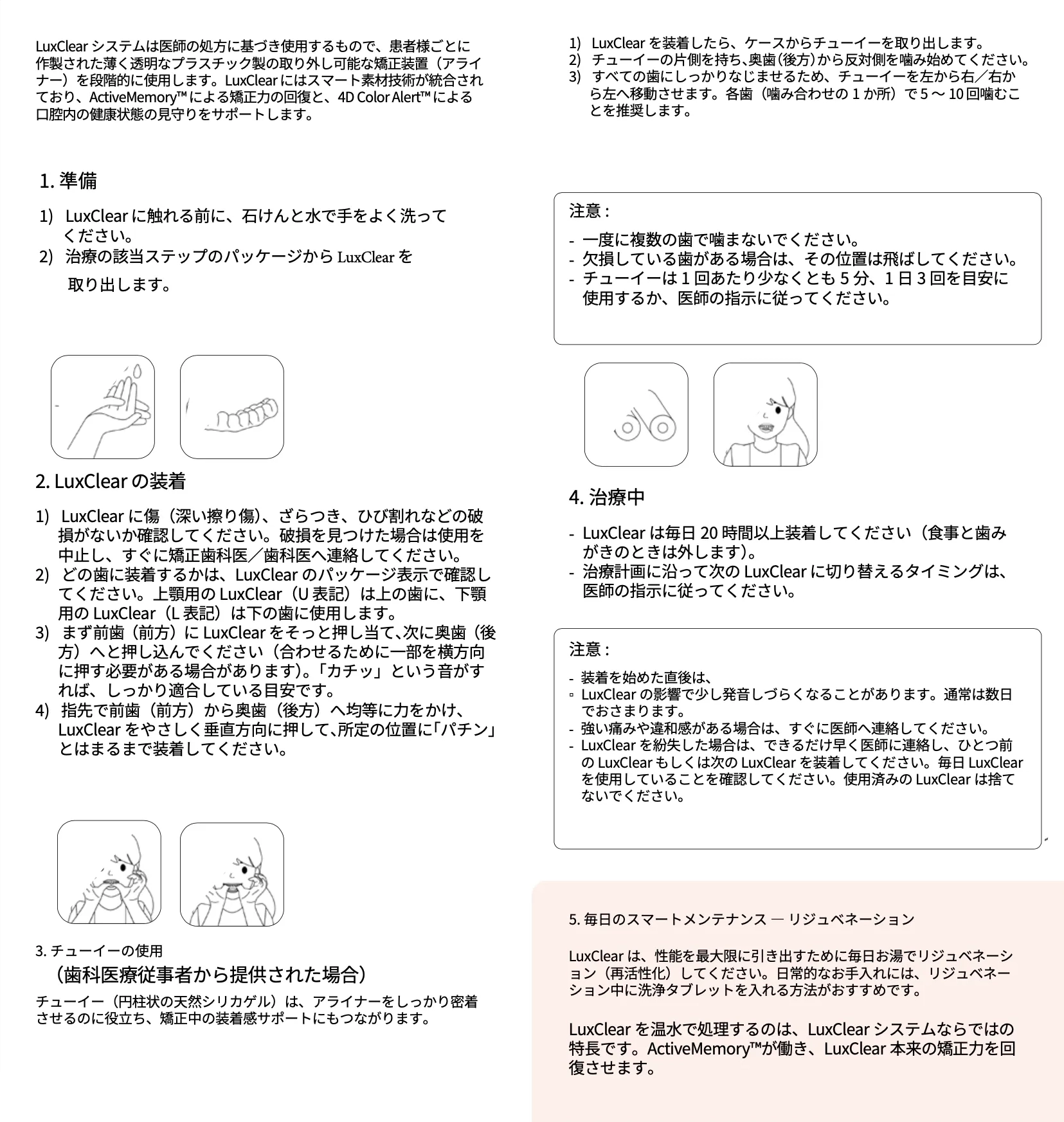 マウスピースの装着